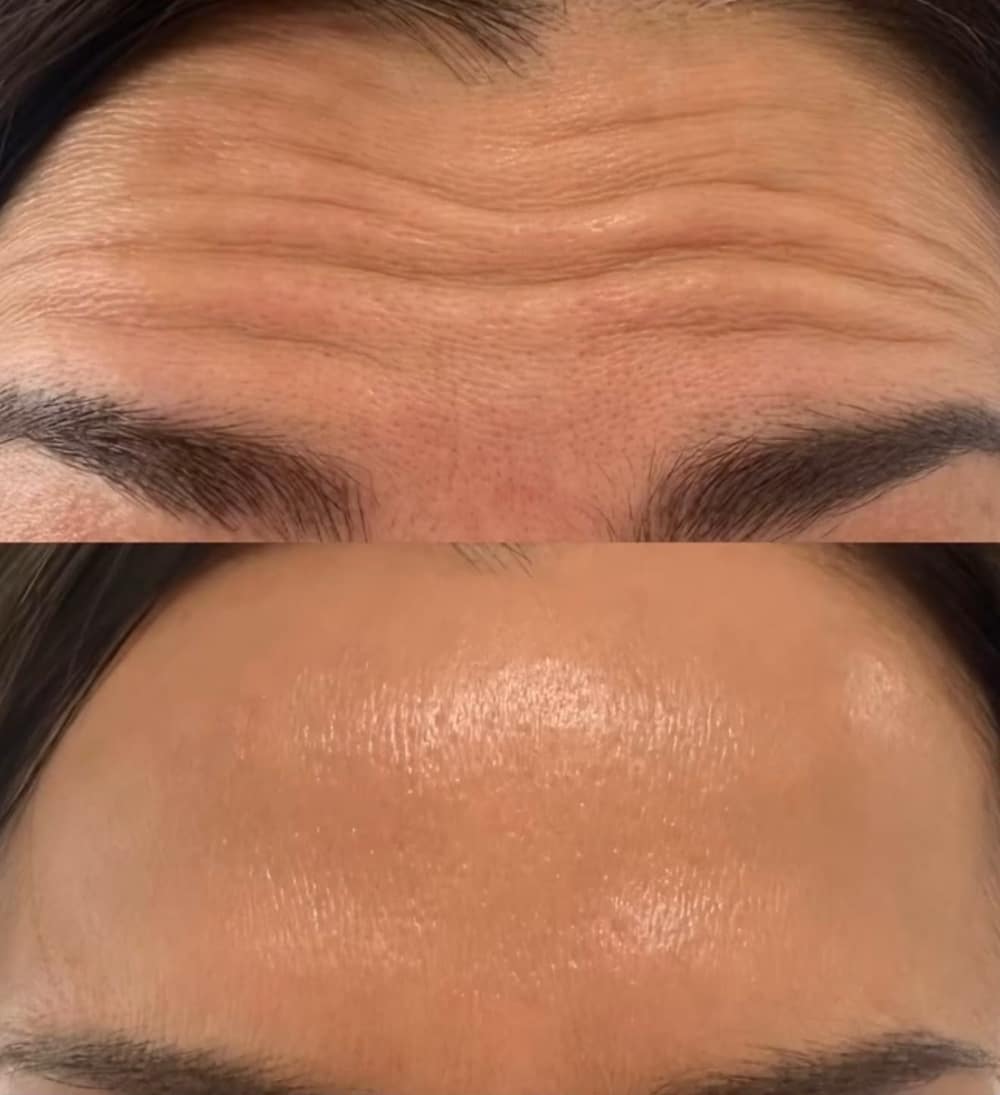 Anti-Wrinkle Treatments at Lady Young's Beauty & Cosmetics, Bracknell
