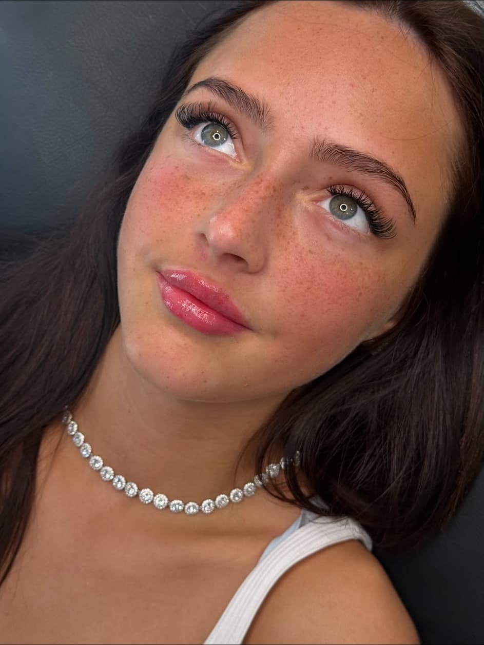 Natural-looking lip filler results on a Lady Young's client
