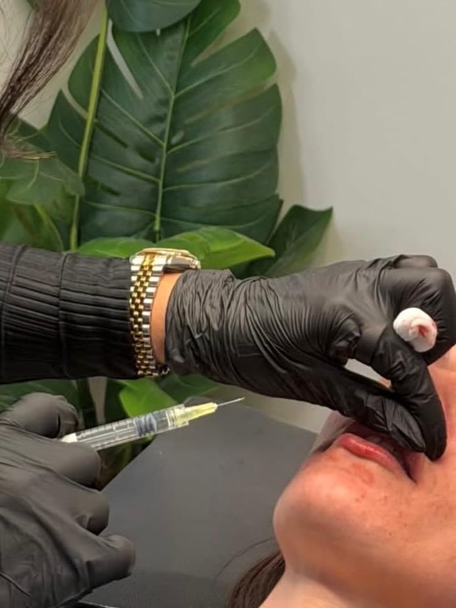 Safina Young carefully placing lip filler for a client at Lady Young's in Bracknell